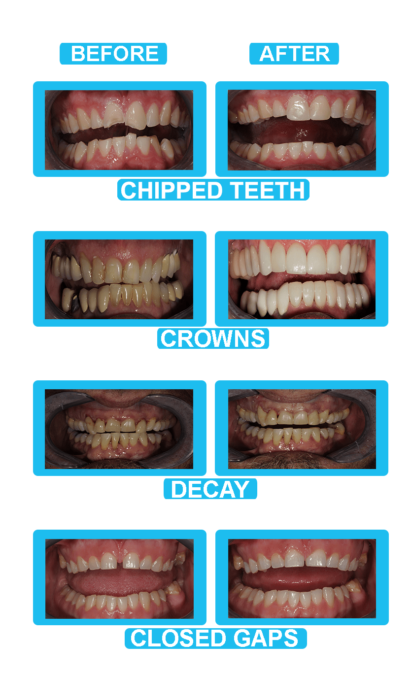TEETH-2-min